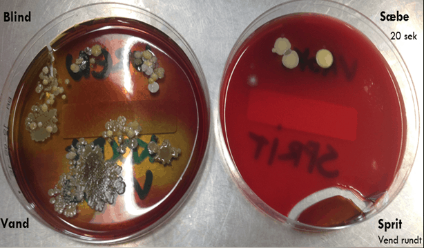 Mikrobiologi CFU med korte negle