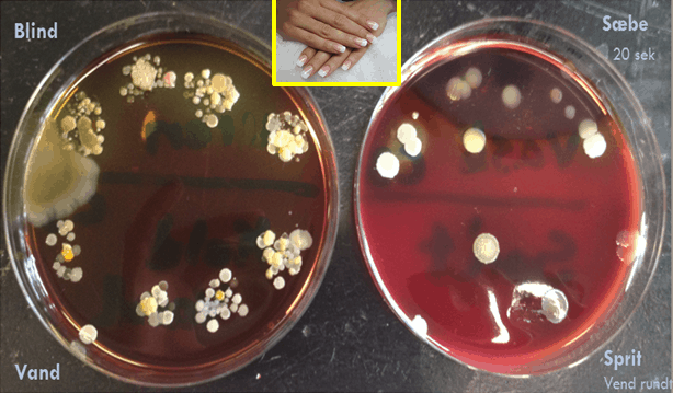 Mikrobiologi CFU med lange negle