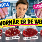 Hvad gemmer der sig af bakterier under korte og lange negle? 5. Hvornår er de væk - mikroorganismer på korte og lange negle